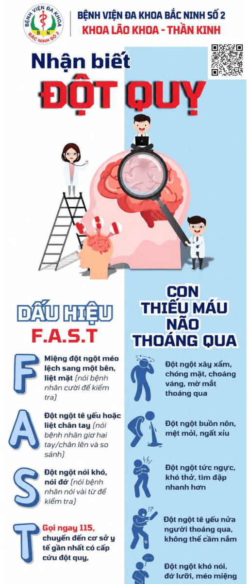 Nhận diện đột quỵ não